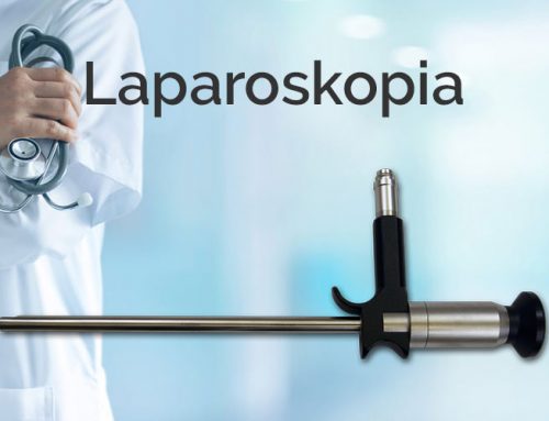 Laparoskopia – opis badania za pomocą laparoskopu